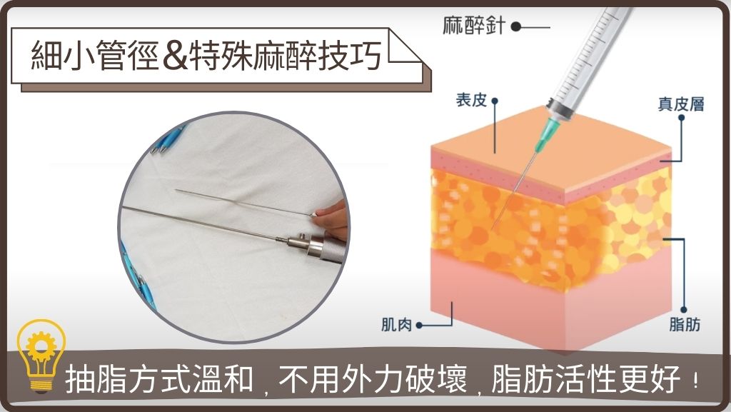顯微套管抽脂細小管徑搭配特殊脹麻技術