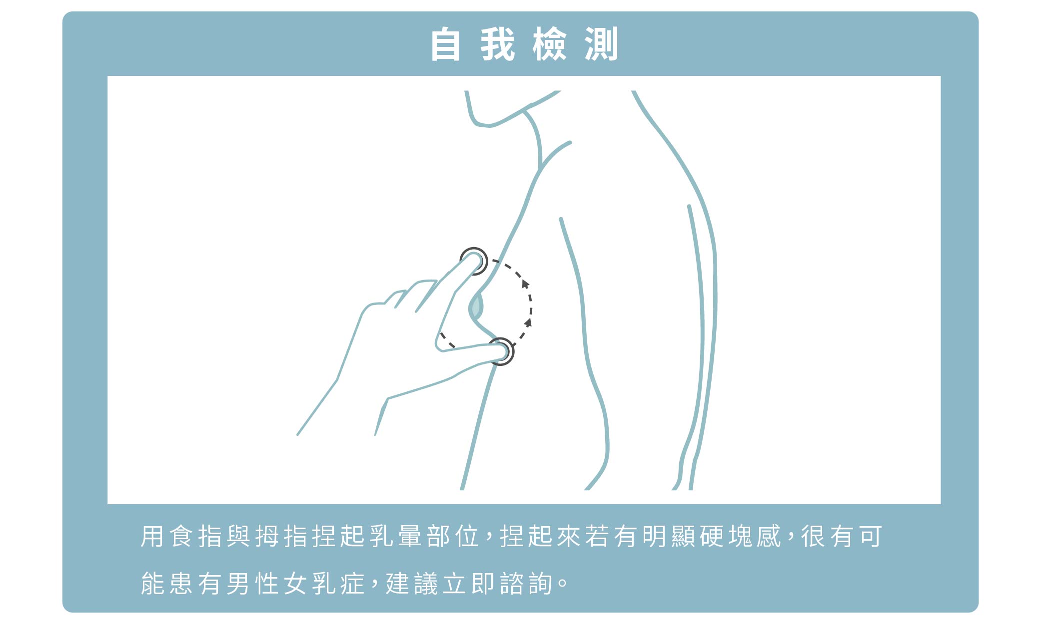了解男性女乳的檢測方式，如何自我檢測?用觸診方式自我評估，若有明顯硬塊，可能患有男性女乳，建議諮詢專業醫師