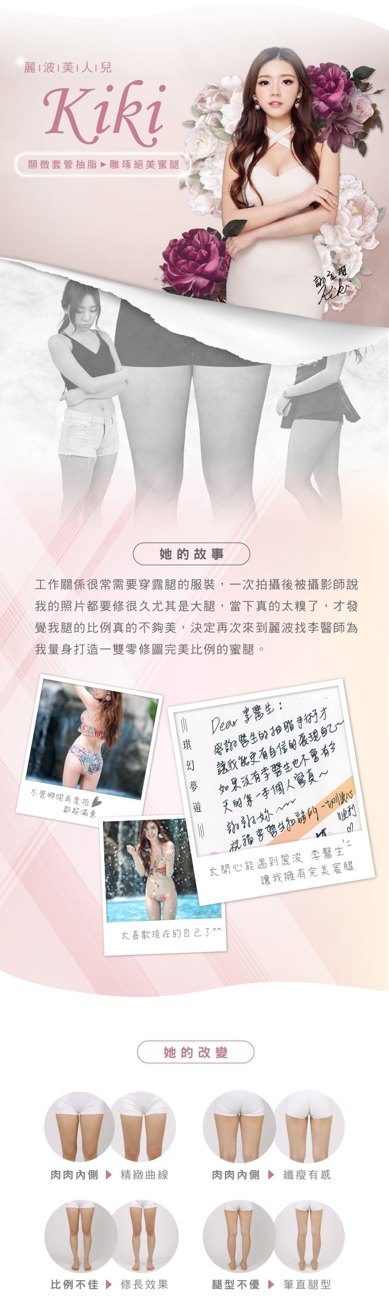 KIKI大腿抽脂案例分享，麗波收集了部分抽脂客人術後成果，有助於了解抽脂後的實際成效，以及顯微套管抽脂運用在大腿抽脂時的優勢，讓你多一個選擇美麗的機會。