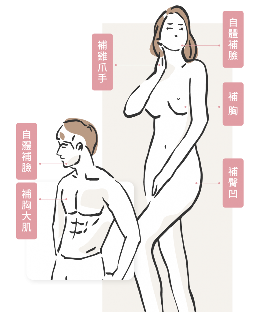 FQA顯微套管取出的脂肪可以應用在多個部位，如自體脂肪補臉、豐胸或臀部凹陷處