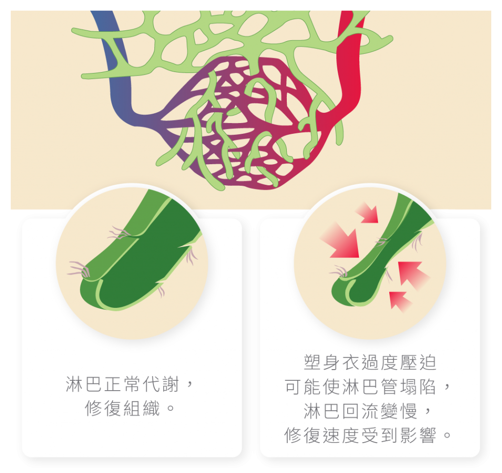 組織修復過程需要淋巴循環，若穿著塑身衣過度壓迫，會使淋巴循環受阻，造成修復時間延長。因此顯微套管抽脂手術不建議穿著塑身衣