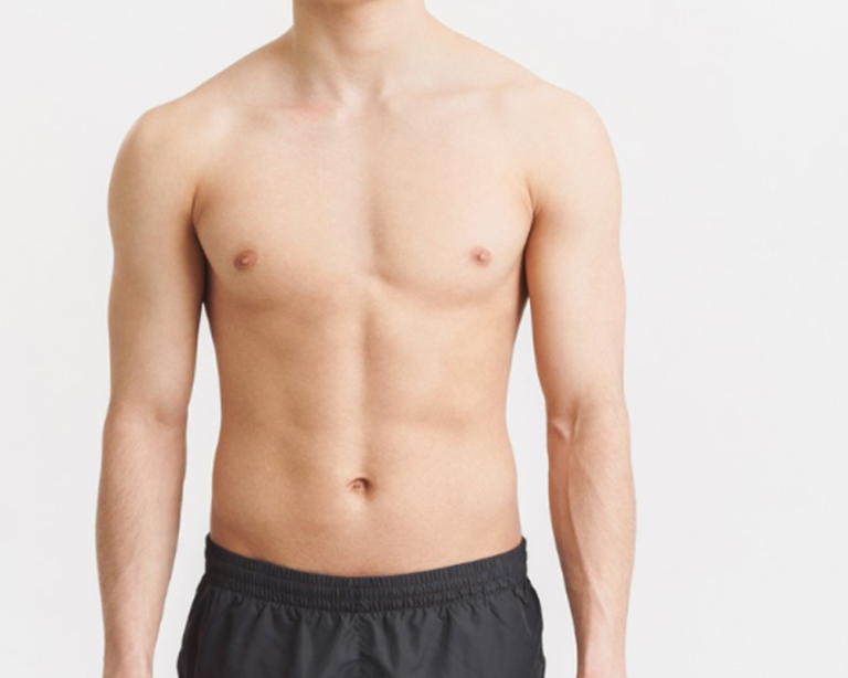 麗波永康男性女乳抽脂手術，幫助你擺脫胸前尷尬的激凸