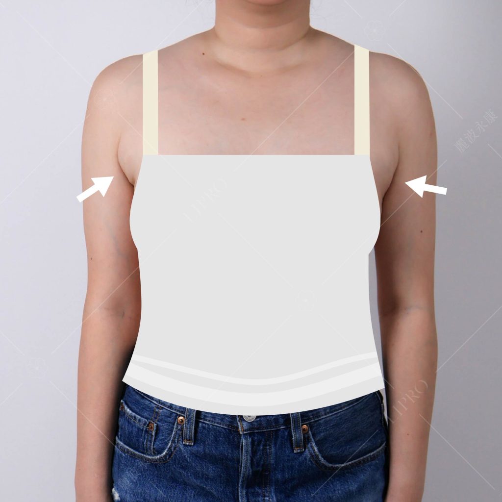 副乳術前困擾_無法駕馭背心，圖為服裝模擬示意