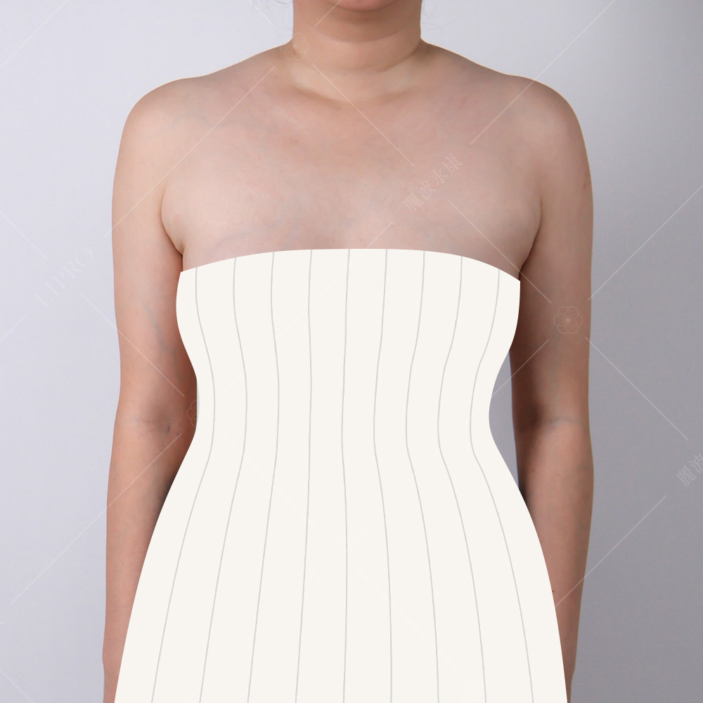 感受一下副乳消除前後的身形差異，穿小禮服給人不一樣的感覺，圖為術前模擬圖