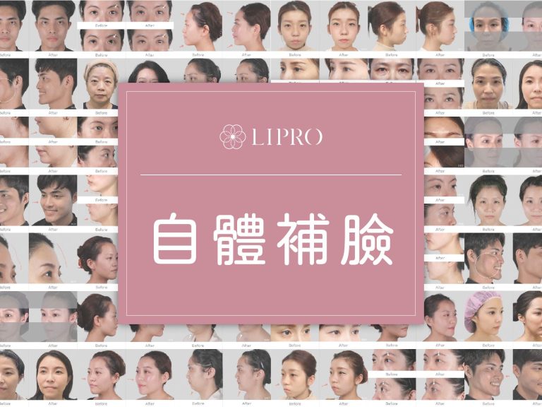 顯微套管抽脂樹feat.精微自體脂肪移植槍(MAFT GUN) ，麗波永康全臉補脂經驗豐富，困難補脂部位輕鬆掌握