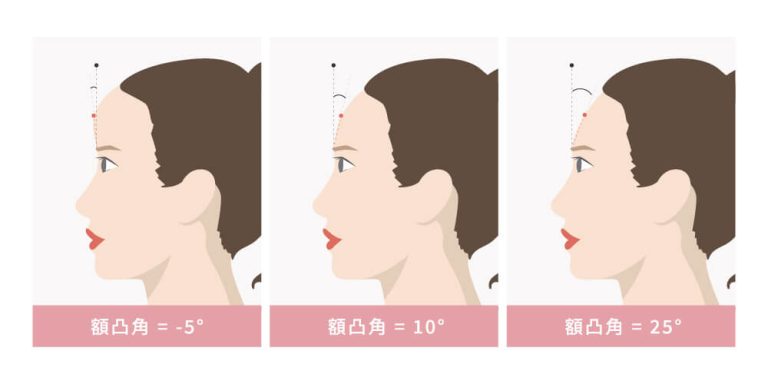 了解前額凸度影響整體美感，額凸角要怎麼看?