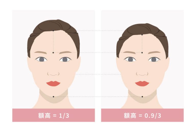 額頭高度影響面部的整體美感，麗波永康前額美學分析示意圖