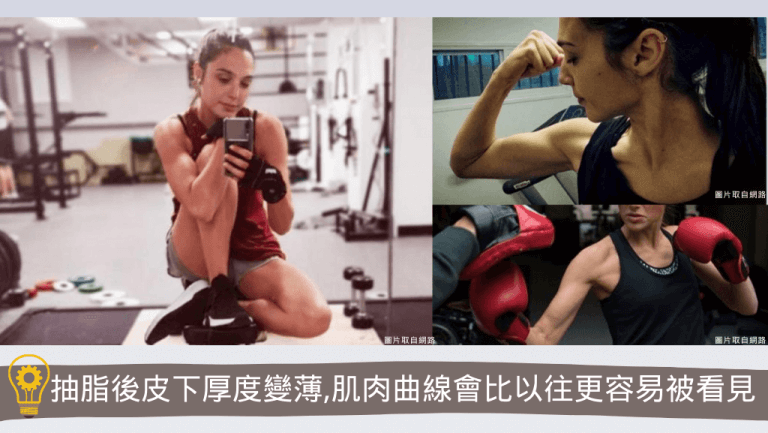 抽脂後皮下脂肪減少，因此肌肉的線條更容易被看到