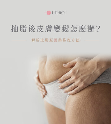 抽脂後一定會鬆弛嗎、皮膚鬆弛的改善方式解析