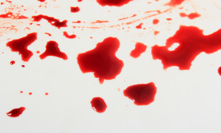 若止血不完全，手術後可能會有持續出血的狀況發生